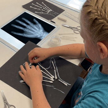 Joey Medical School